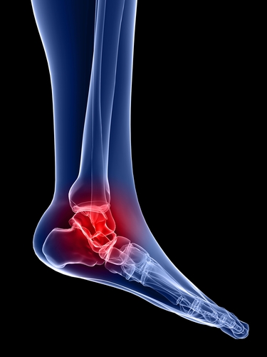 Foot and Ankle Physical Therapy - BreakThrough Physical Therapy